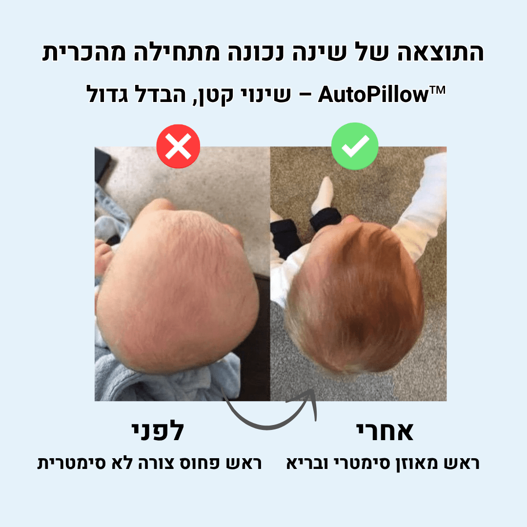 הכרית שמונעת ראש שטוח מבית CELVO